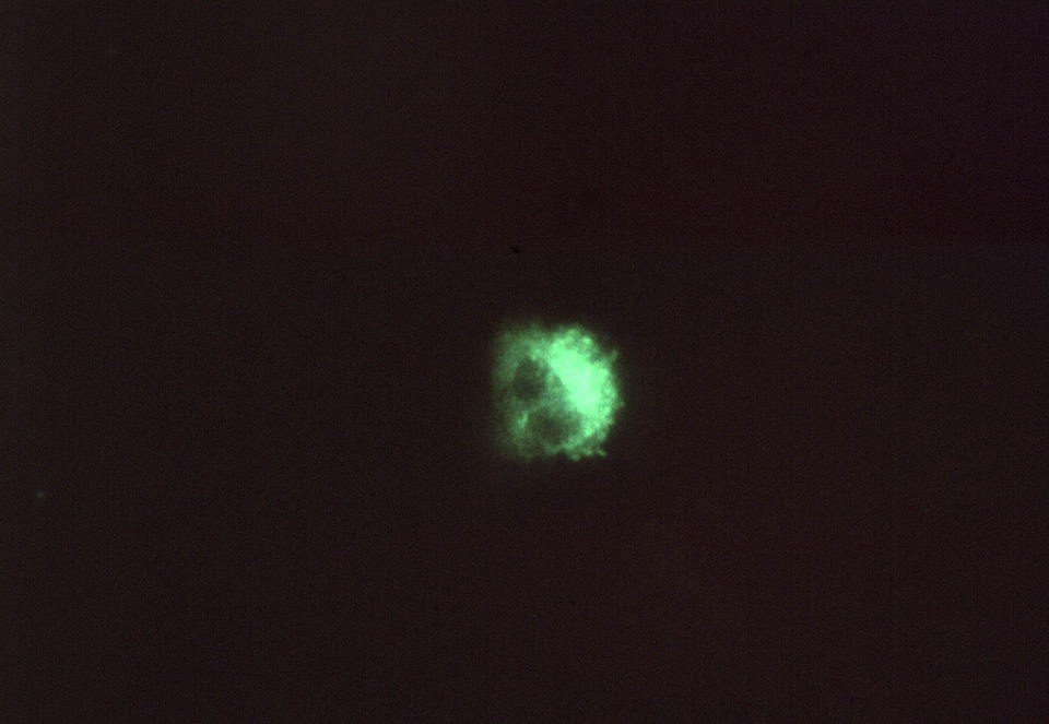 Autumn chlamydia psittacosis