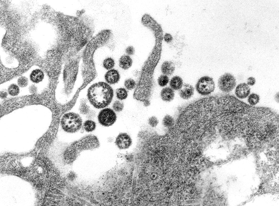 Adjacent cell debris