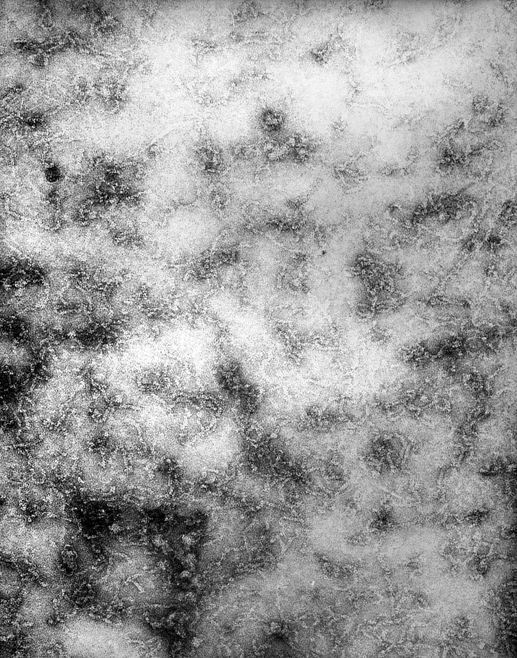 Crosse presence virus