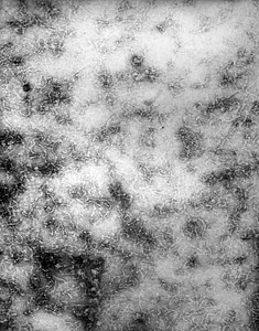Crosse presence virus