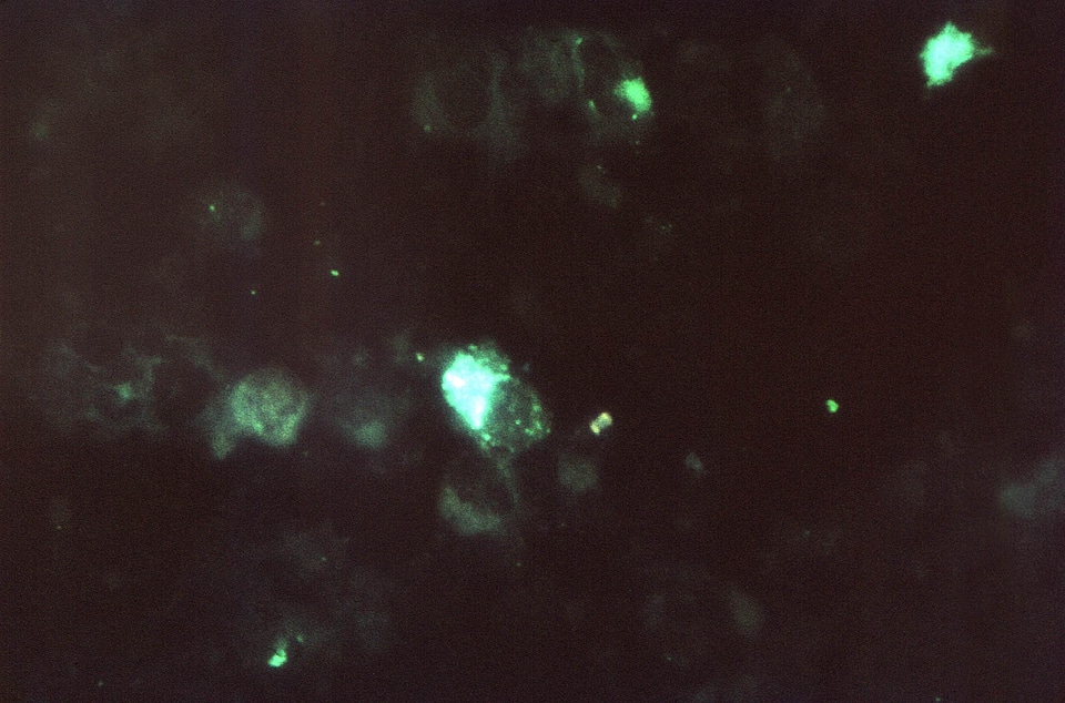 Chlamydia photomicrograph positive