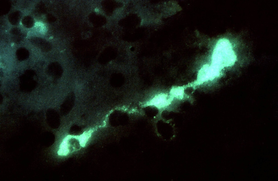 Bacteria brain chlamydia