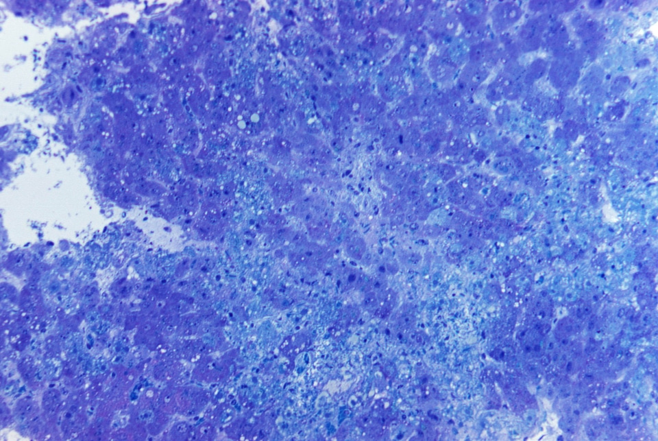 Azure blue photomicrograph