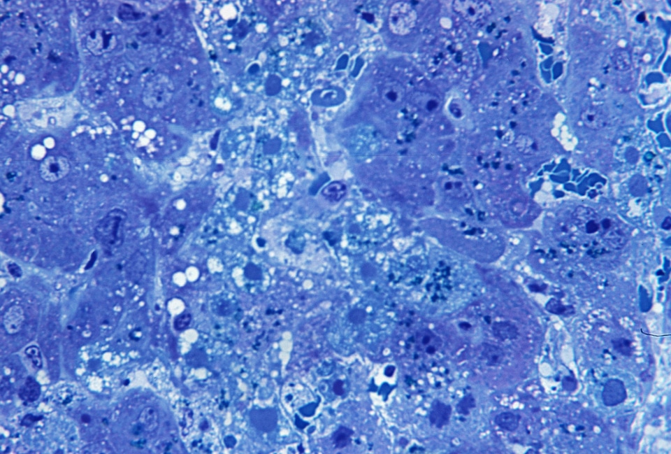 Azure blue photomicrograph