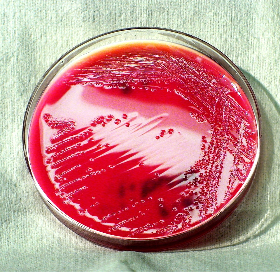 Bacteria gram negative