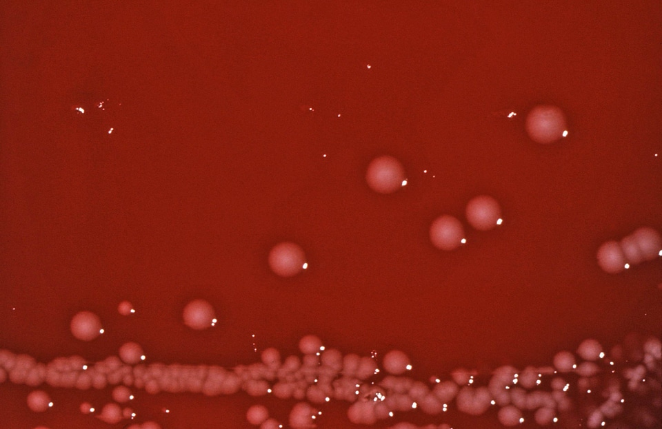 Bacteria blood colonial