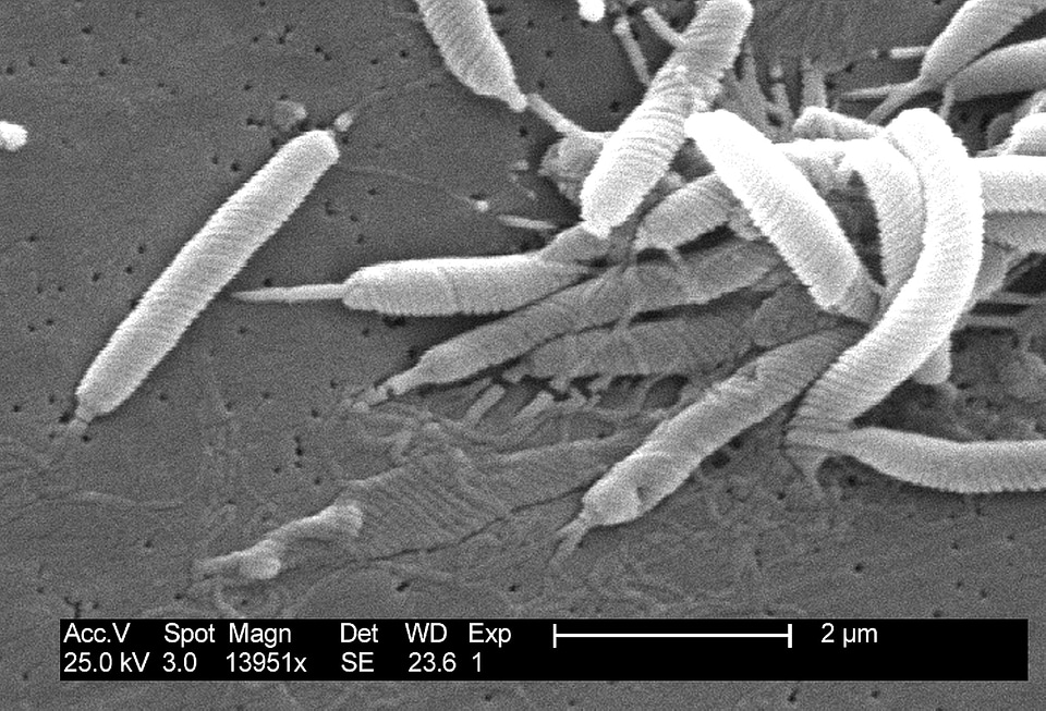 Bacteria gram negative
