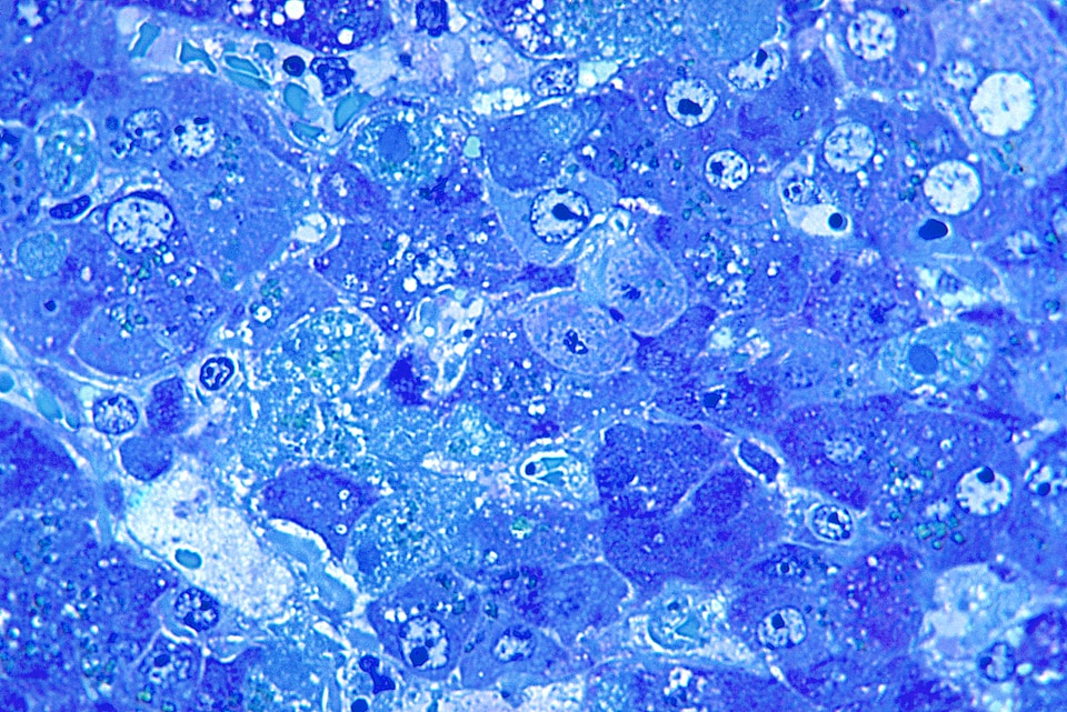 Azure blue photomicrograph