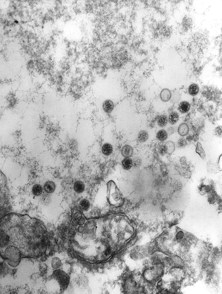 Family human virus