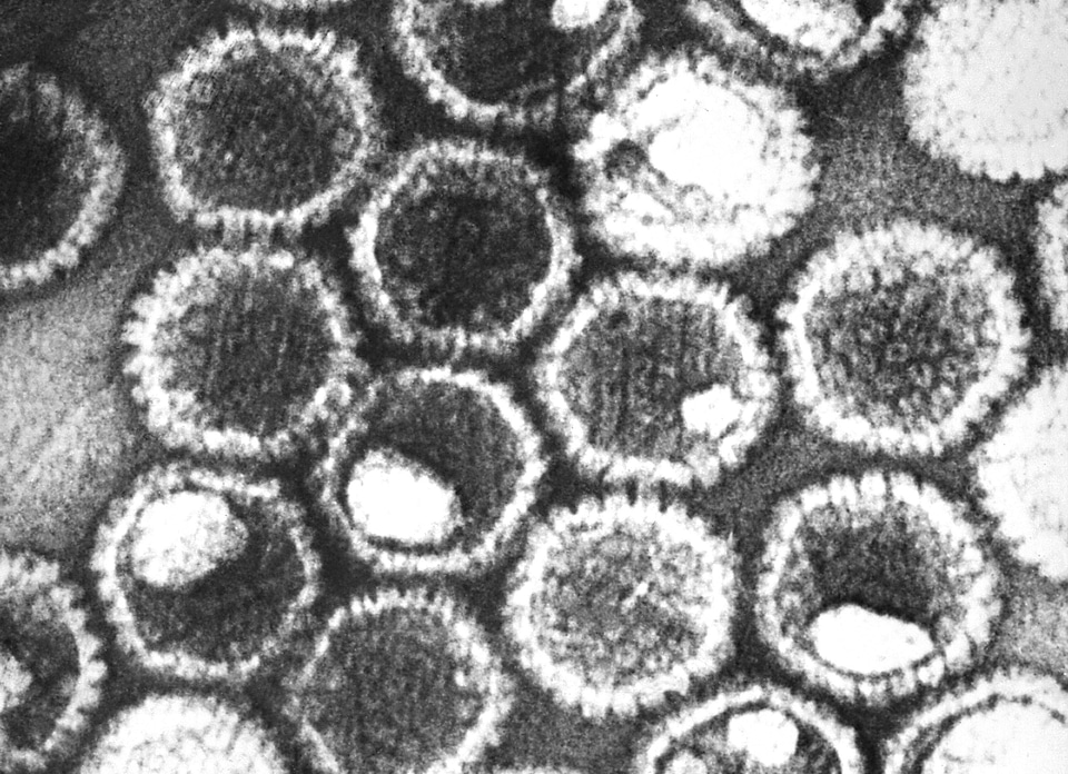 Family herpes herpes simplex