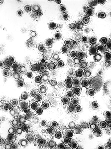 Electron electron micrograph herpes photo