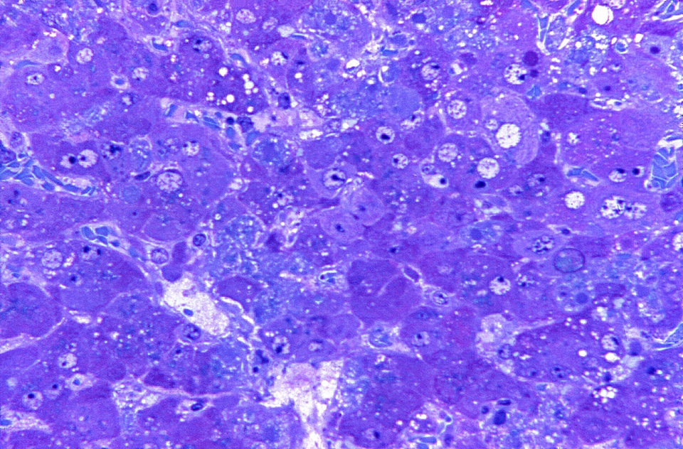 Cause inflammation liver
