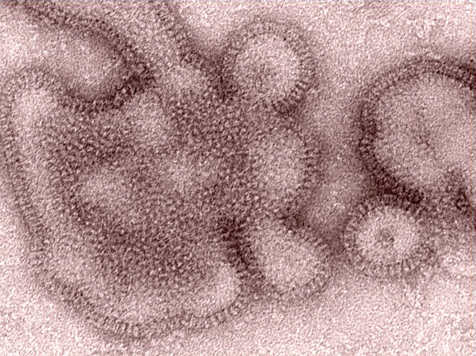 Details influenza ultrastructural