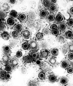 Family herpes herpes simplex