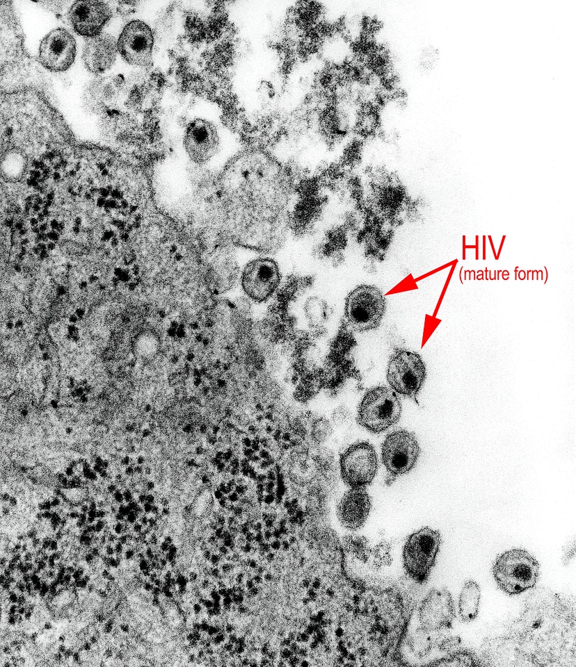 Human immunodeficiency retrovirus