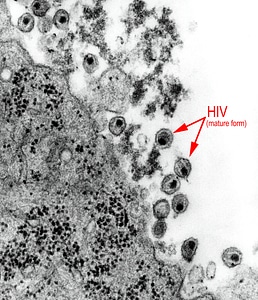 Human immunodeficiency retrovirus photo
