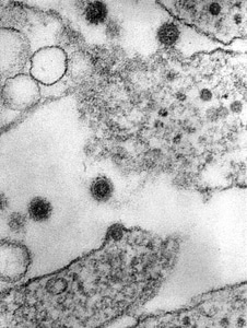 Equine equine encephalitis virus