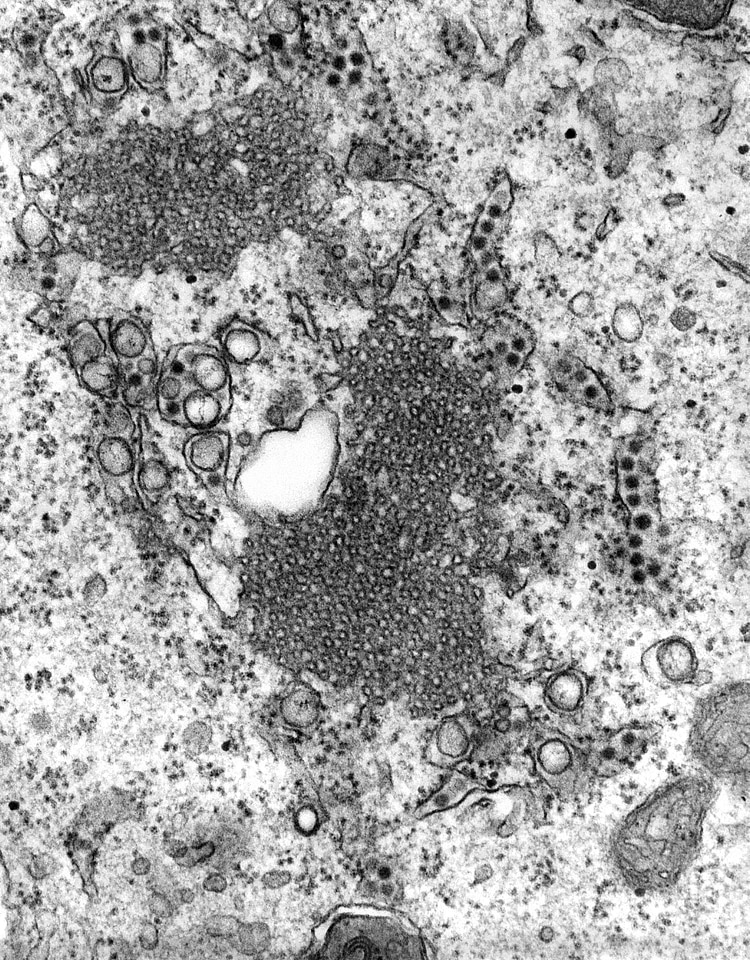Nervous System powerhouse presence