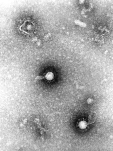 Alphavirus family genus
