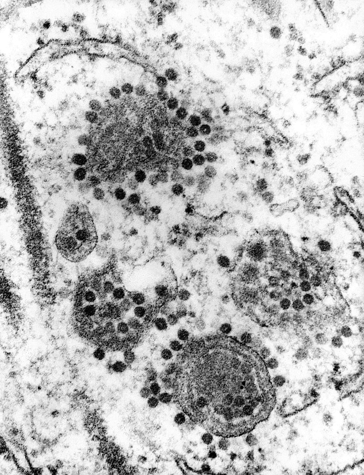 Equine equine encephalitis number
