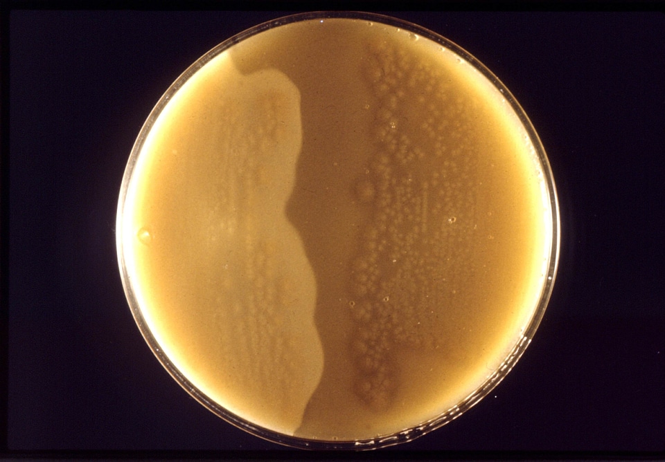 Antitoxin clostridium court