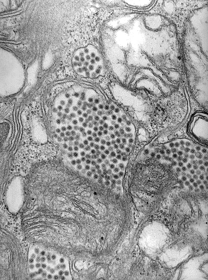 Alphavirus electron micrograph equine