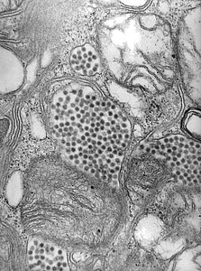 Alphavirus electron micrograph equine