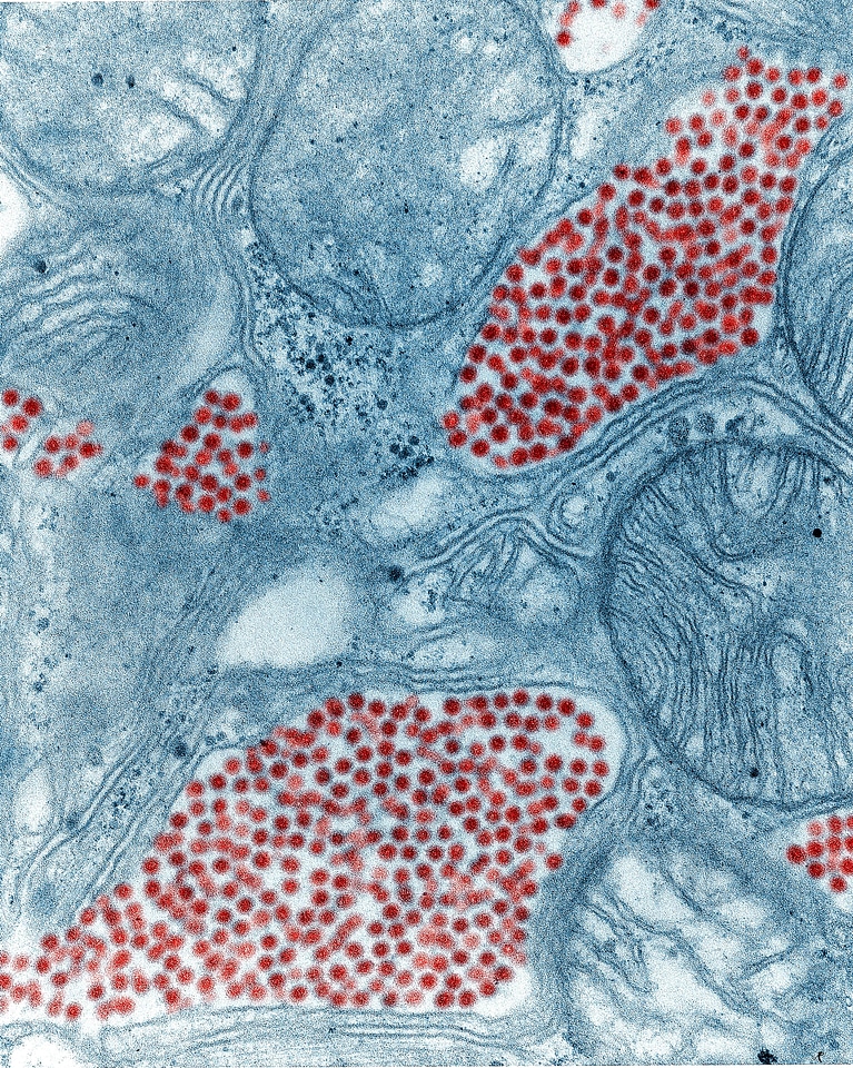 Equine equine encephalitis gland