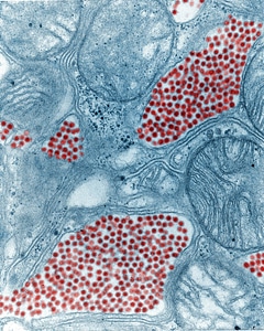 Equine equine encephalitis gland