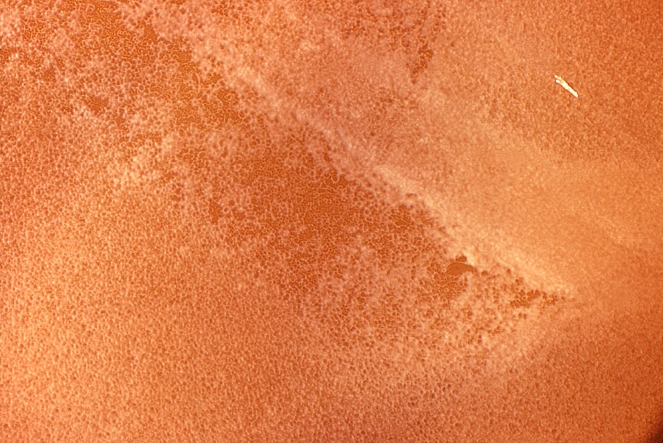 Bacteria clostridium culture