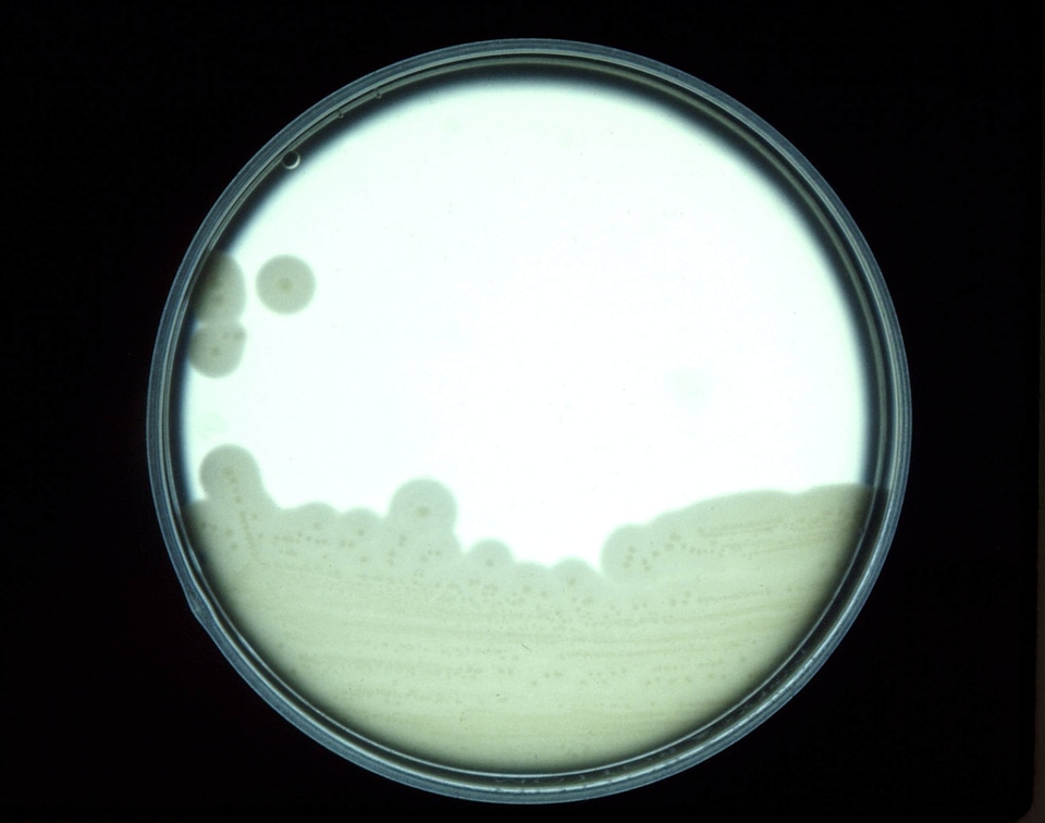 Clostridium egg egg yolk