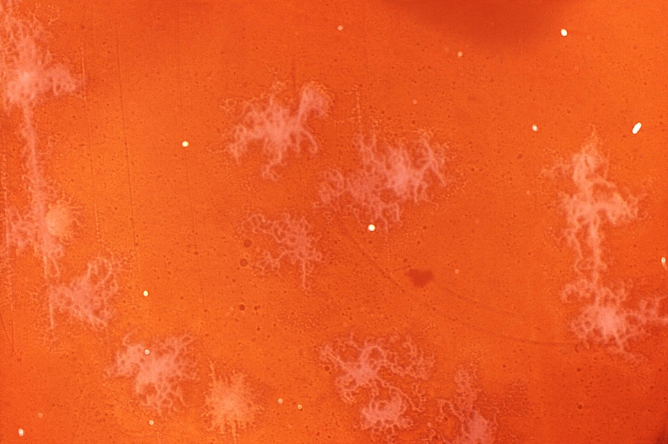 Bacteria clostridium court