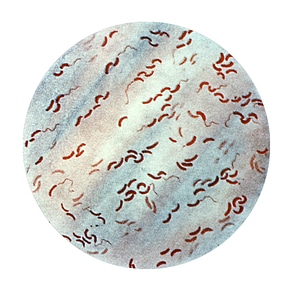 Bacteria cargo cause