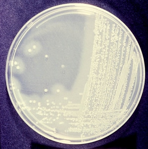 Agent bacteria causal agent photo