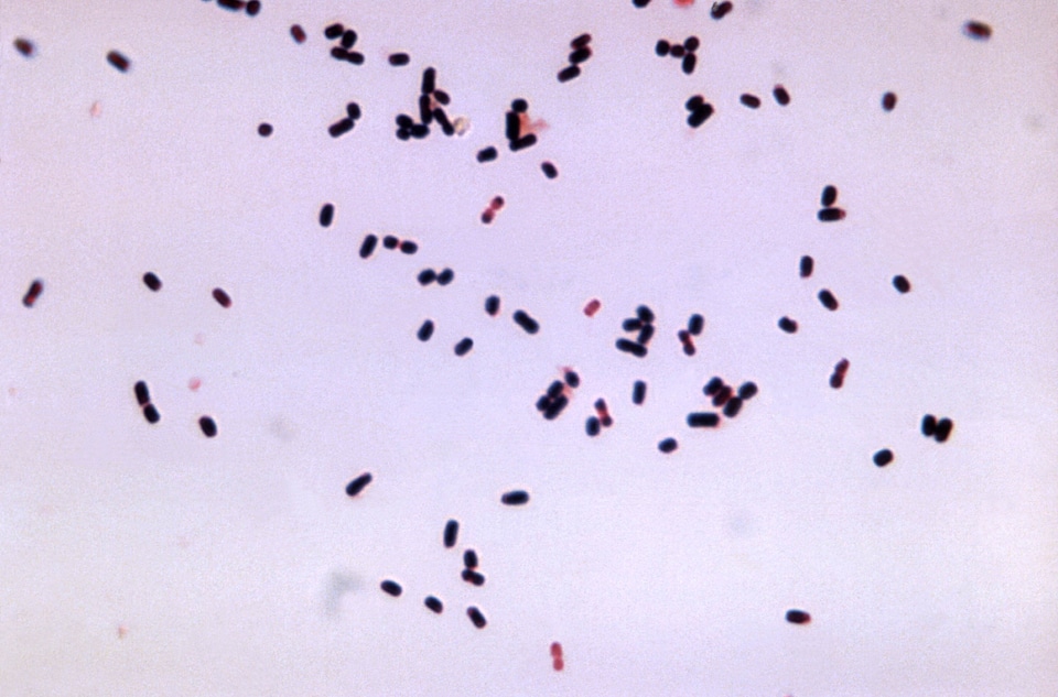 Clostridium gram photomicrograph