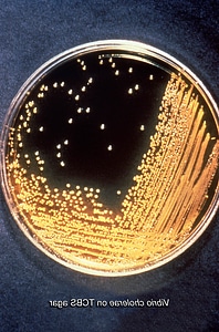 Citrate means sucrose photo