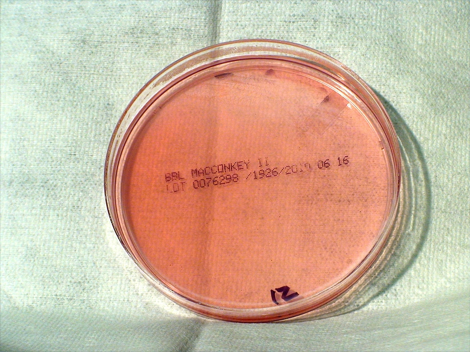 Gram morphology negative