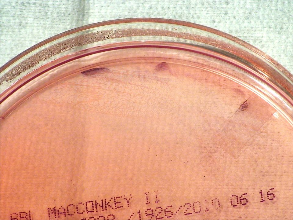 Bacteria hour means