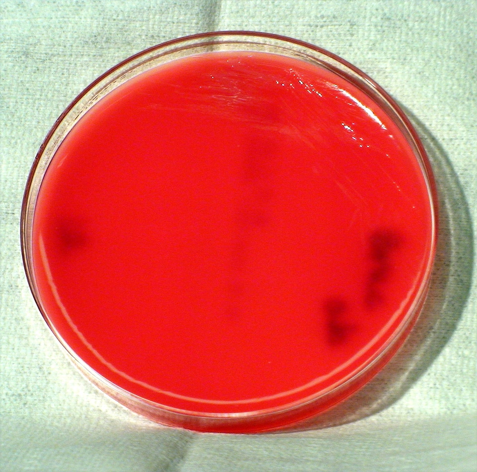 Abortus bacteria colonial