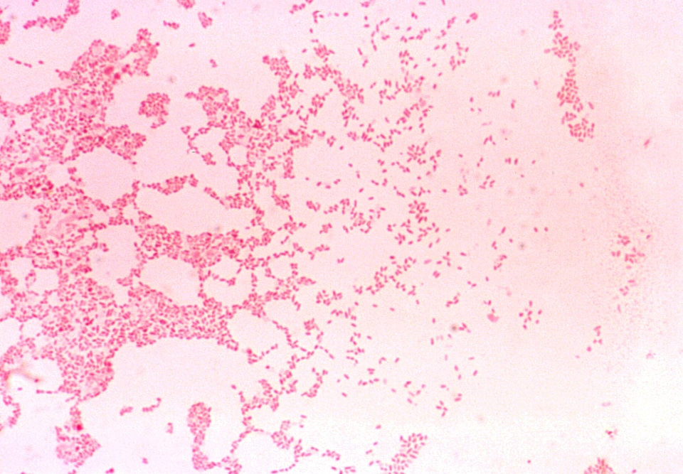Cause coccobacillus coloration