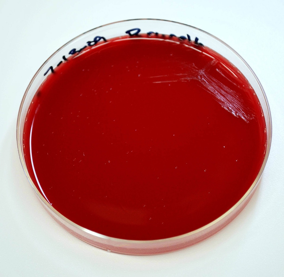 Abortus blood blood agar