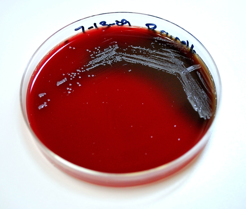 Gram metallic negative