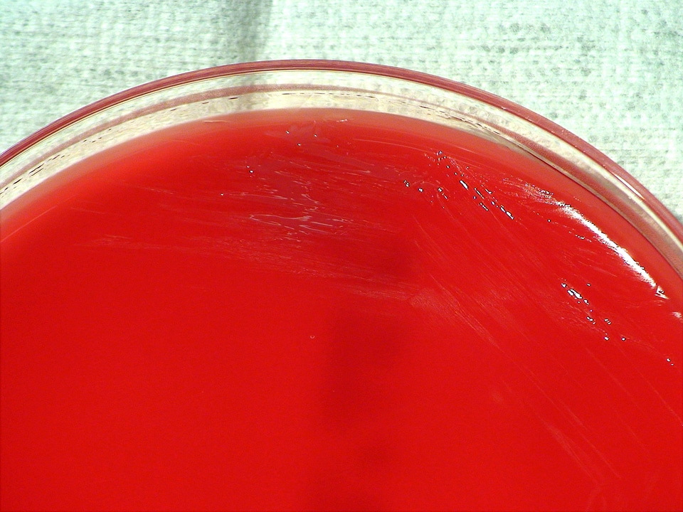 Abortus brucellosis cause