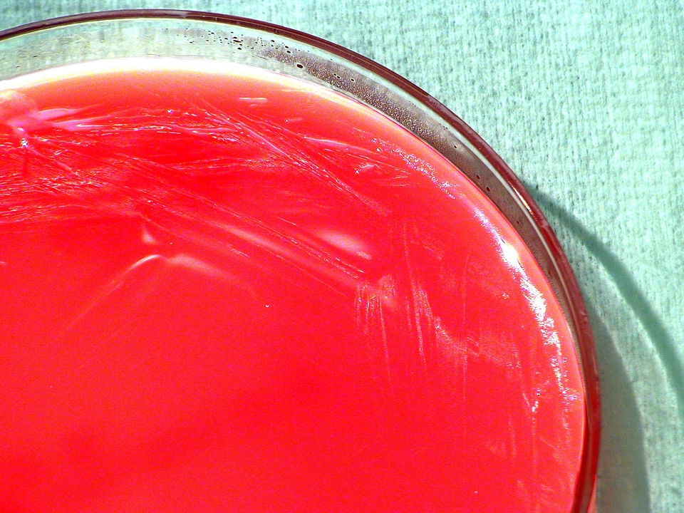 Bacteria brucellosis causal agent