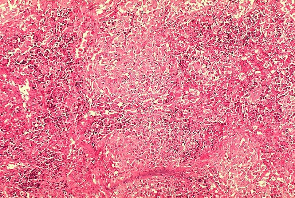 Guinea Pig Gvineja histopathology