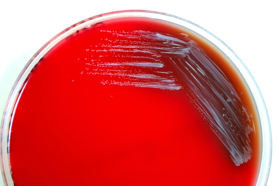 Abortus bacteria blood
