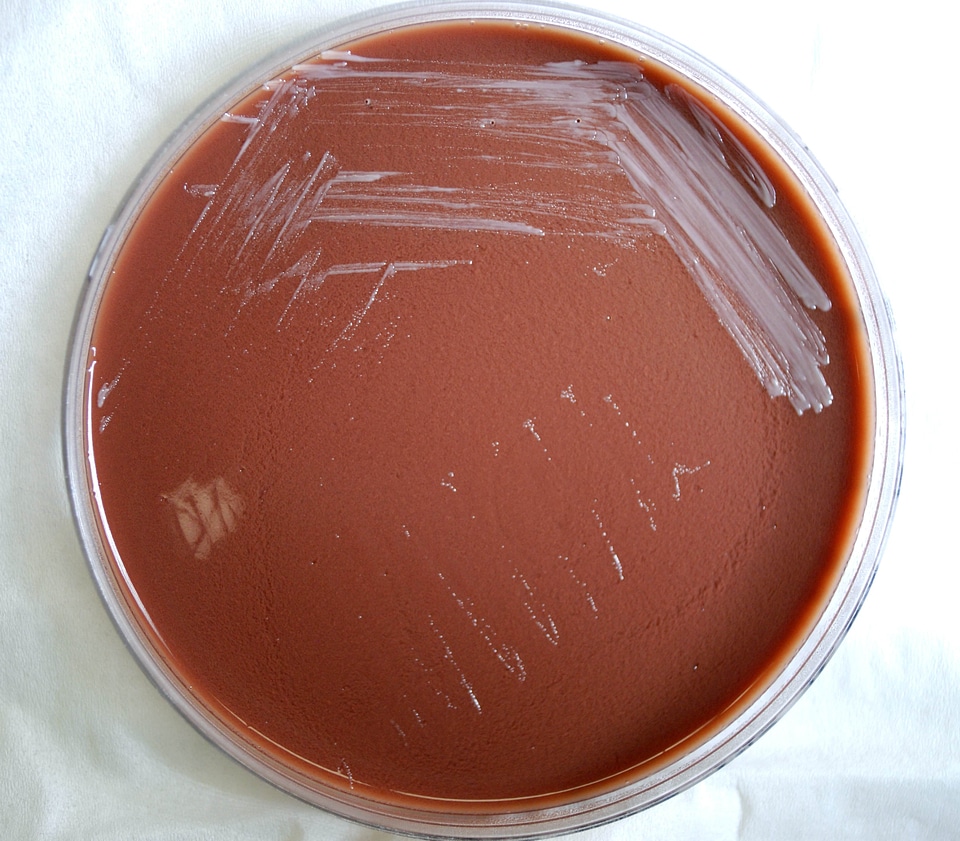 Abortus bacteria chocolate