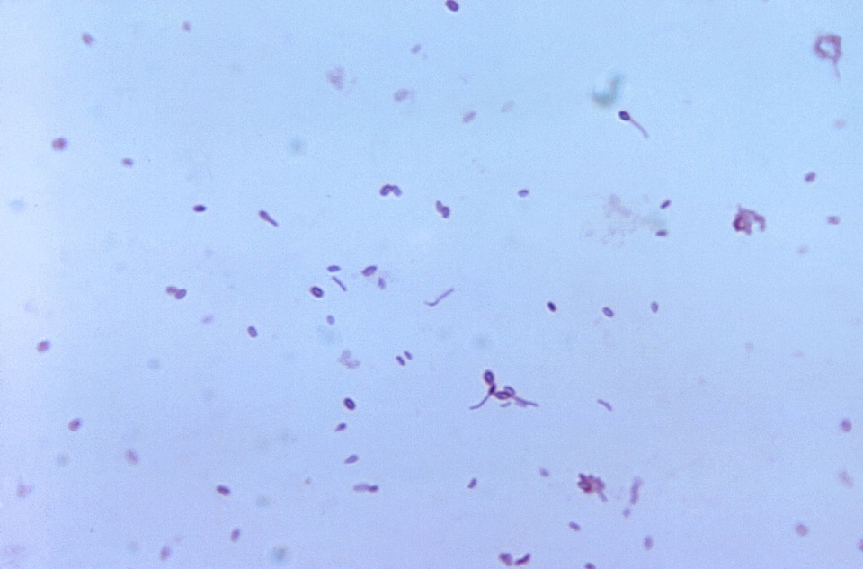 Bacteria blood blood agar