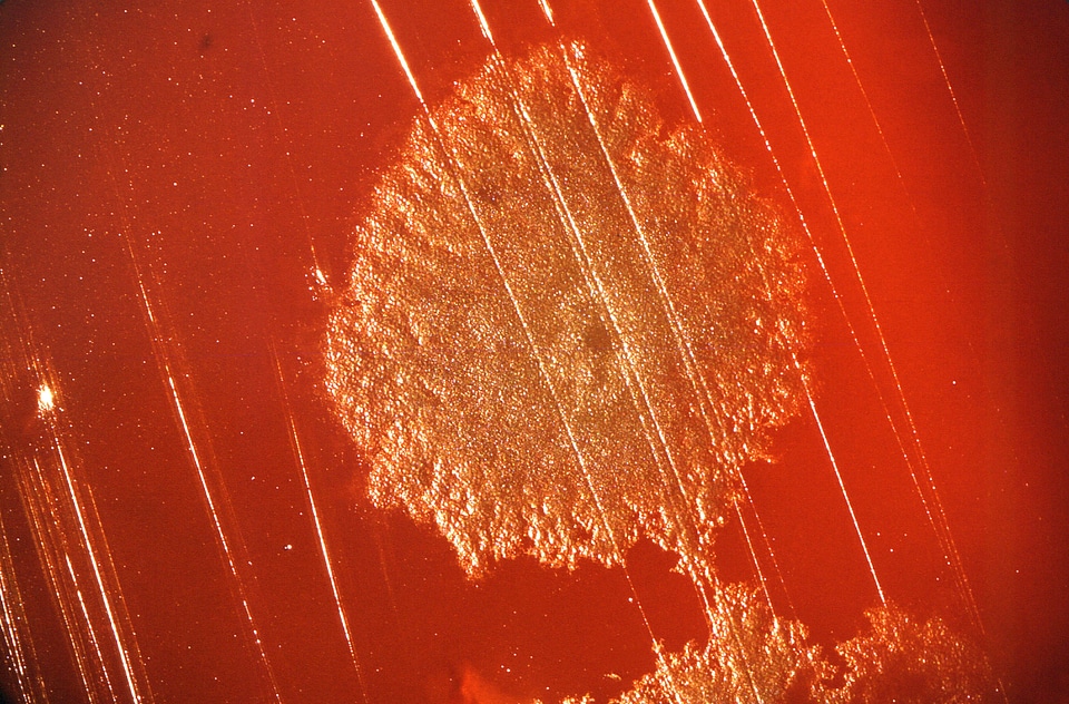Bacteria blood colony