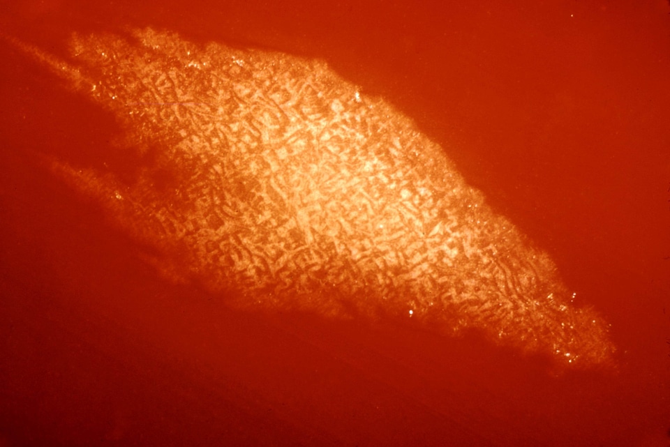 Blood clostridium colony